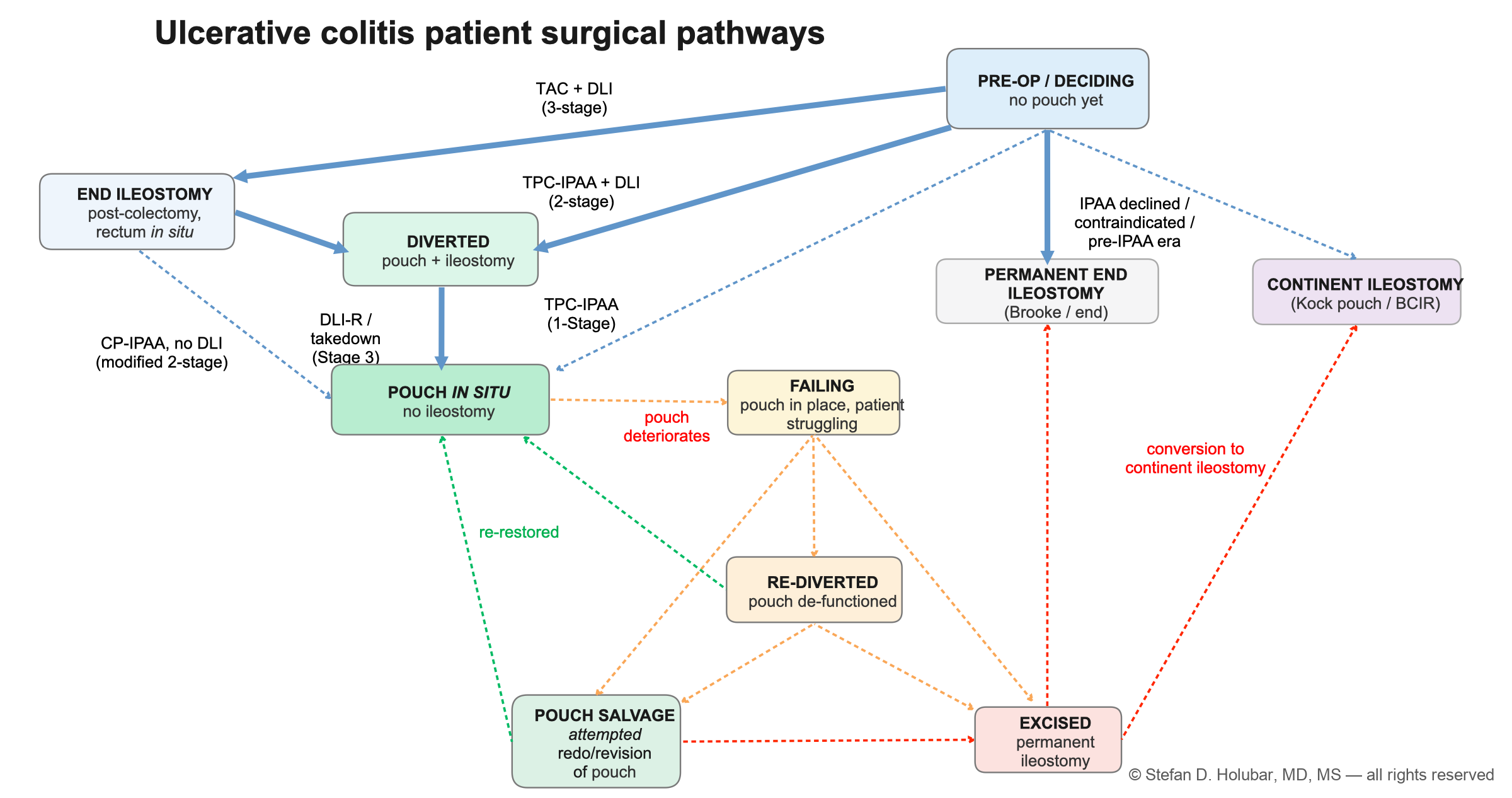Algorithm of ulcerative colitis surgical pathways. Pre-operative deciding states (3-stage total abdominal colectomy with diverting loop ileostomy, end ileostomy with rectum in situ, or IPAA declined) lead to staged ileal pouch-anal anastomosis routes (1-stage total proctocolectomy with IPAA, 2-stage total proctocolectomy with IPAA and diverting loop ileostomy, modified 2-stage completion proctectomy with IPAA and no diversion) and stage-3 ileostomy takedown; pouch states include diverted, in situ, failing, salvage, re-diverted, and excised; terminal states are permanent end ileostomy and continent ileostomy (Kock pouch or BCIR).